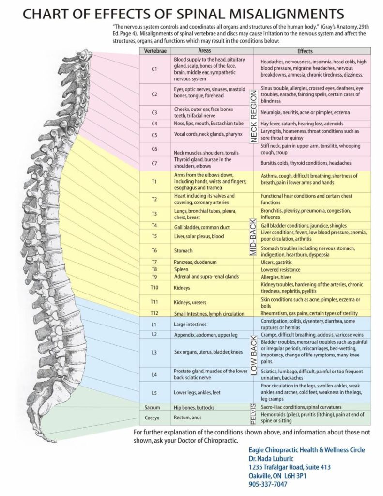 Spinal Misalignment Chart